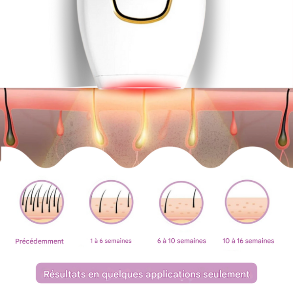 Épilateur IPL | Azer™