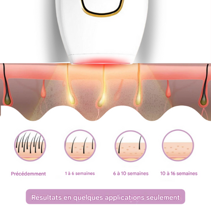 Épilateur IPL | Azer™